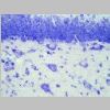 Neuronas Nissl 22.jpg